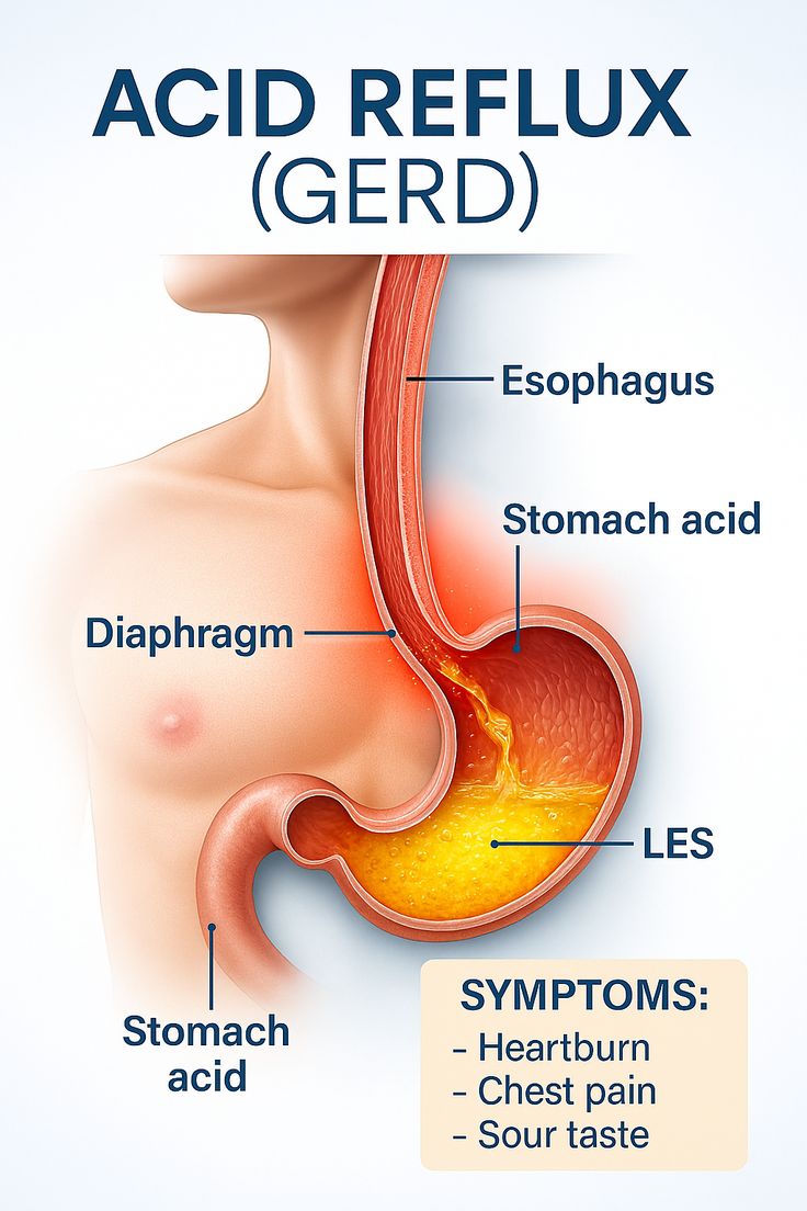 GERD Acid Reflux Treatment Guntur