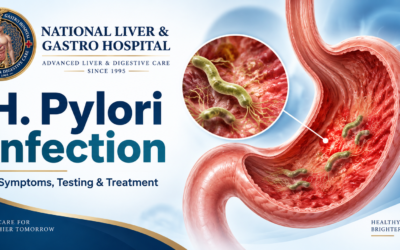 H. Pylori Infection: Symptoms, Testing, Treatment and When to See a Gastroenterologist in Guntur